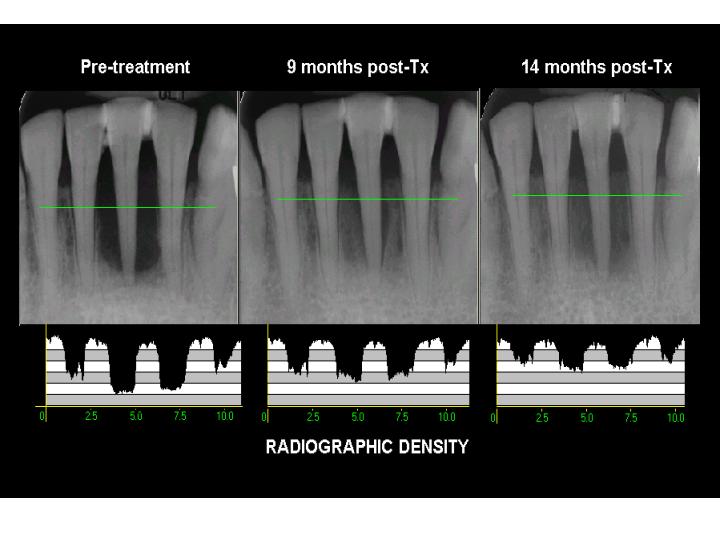 3 series bone density.jpg